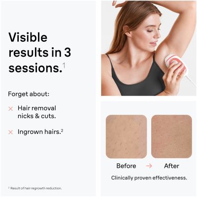 Braun IPL SilkﾷExpert Mini PL1014 Latest Generation IPL, At-home Hair Removal